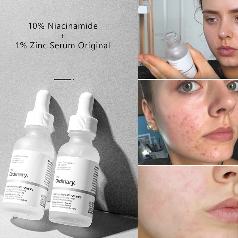 THE ORDINARY Niacinamide Serum - Clear Your Skin